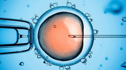 Neues Leben. Unter dem Mikroskop wird mit einer winzigen Stechkanüle ein Spermium in eine Eizelle injiziert.