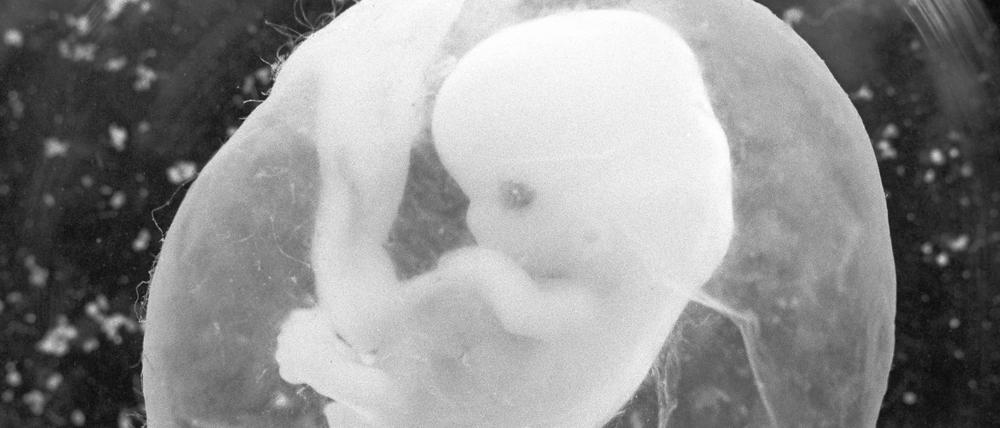 Das undatierte Foto zeigt einen sieben Wochen alten Fötus in einer Fruchtblase.