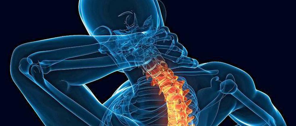 „Wie eine Bambusstange, die gleich bricht.“ Schmerzpatienten klagen am häufigsten über Rückenleiden. Auch Kopfschmerzen sind weit verbreitet.