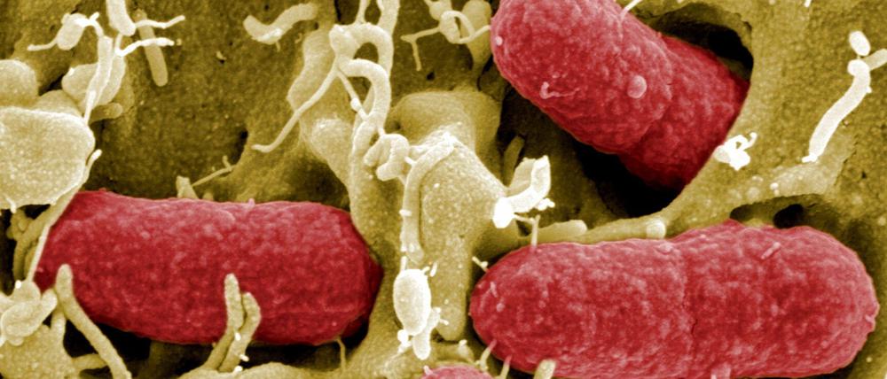 EHEC-Keime sind eine besonders gefährliche Form des Darmbakteriums Escherichia coli.