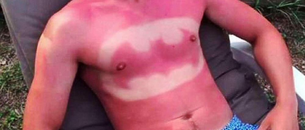 Ein Batman-Tattoo auf der Brust eines Twitter-Nutzers aus Frankreich, veröffentlich unter dem Hashtag #sunburnart. 