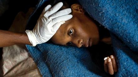Eine HIV-positive Patientin in einer Krankenstation in Ha Ramajoro/Lesotho mit ihrem antiretroviralen Medikament. Die Vereinten Nationen melden Fortschritte bei der Behandlung von HIV-positiven Menschen.