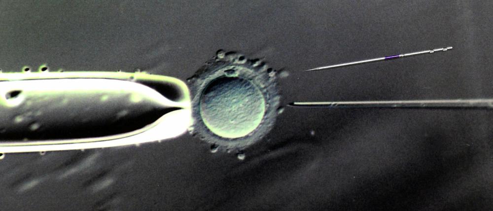 Künstlicher Zeugungsakt im biologischen Labor des Zentrums für Reproduktionsmedizin an der Universitätsfrauenklinik in Leipzig.