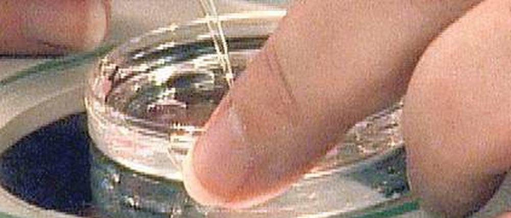 Künstlich befruchtet. Frauen können im Ausland riskante Mehrlingsschwangerschaften umgehen.