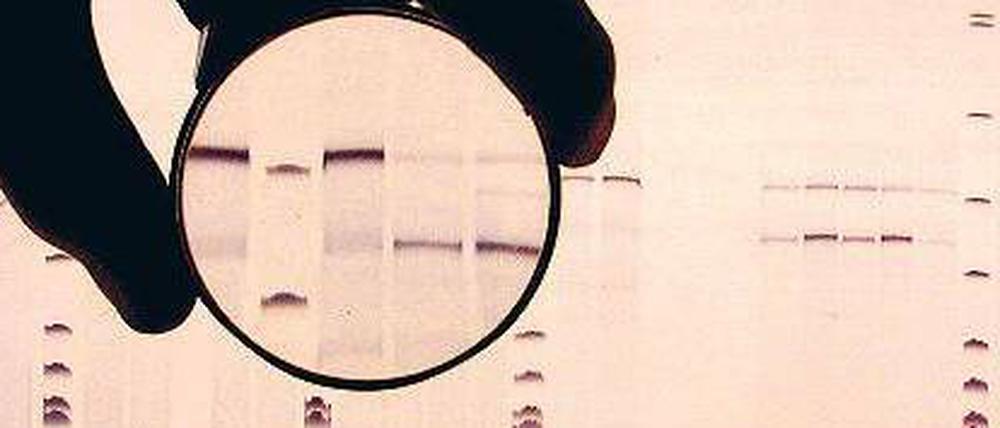 Im Labor liegen geblieben. Viele DNA-Spuren von möglichen Tätern werden nicht untersucht – und Straftaten deshalb möglicherweise nicht aufgeklärt.
