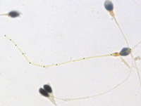 Japanische Forscher legen Maus-Spermien lahm