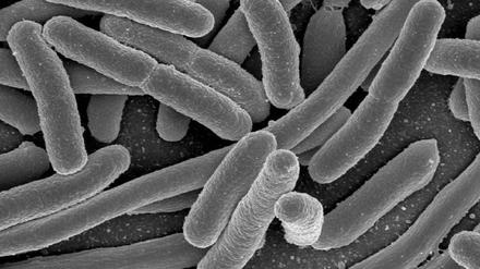 Im menschlichen Darmbakterium Escherichia coli stießen Forscher schon Ende der 1980er Jahre auf einen natürlichen Prozess, der es ihnen heute erlaubt, jedes Erbgut zu verändern, ohne Spuren zu hinterlassen.
