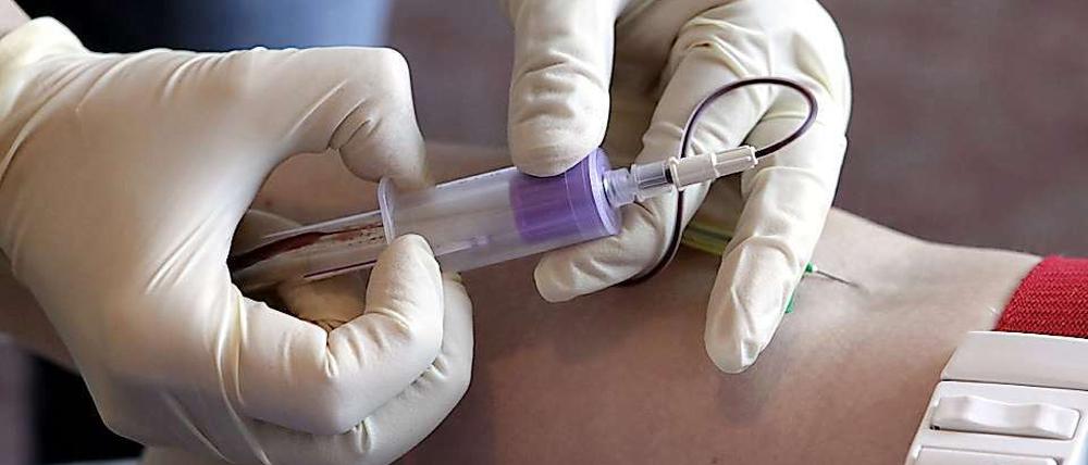 Sachsen-Anhalt will verpflichtende HIV-Tests für Risikogruppen einführen.