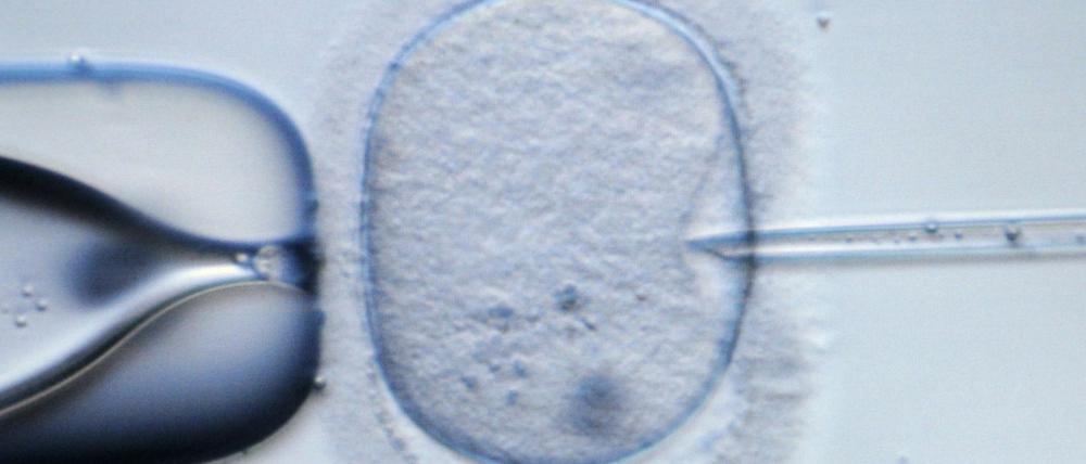 Die Debatte über Gentests an Embryonen geht weiter.