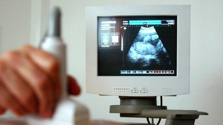 Schwangerschaft im Ultraschall. Die Information darüber, dass sie auch Abbrüche durchführen, verbietet Ärzten aktuell der Paragraf 219a.