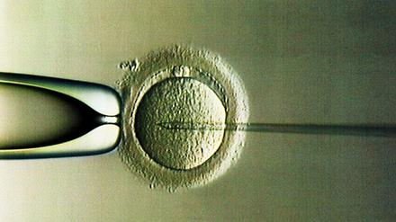 Befruchtung im Labor. Gentests vor der Implantation sind zwar mit Einschränkung erlaubt, müssen bisher aber selber bezahlt werden.