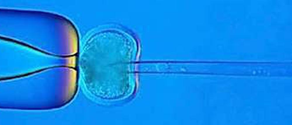 Der Europäische Gerichtshof verbietet Patentierbarkeit von Stammzellen 