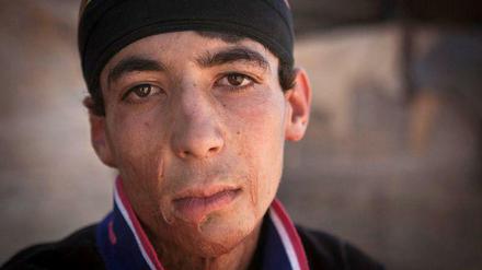 Kriegsopfer: Mohammad (17) lebt heute in einem Flüchtlingscamp.