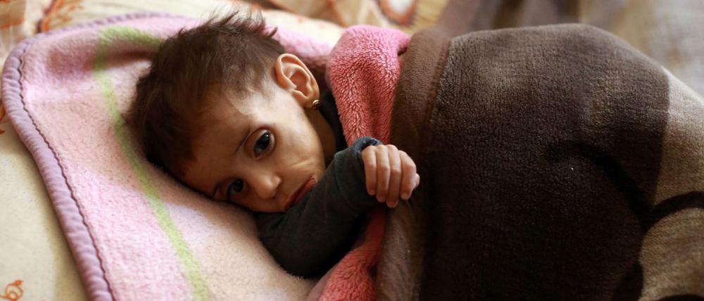 Gefährlich unterernährt. Unicef und anderen Hilfsorganisation wie Save the Children zufolge sind hunderte Kinder in Ost-Ghouta in Lebensgefahr.
