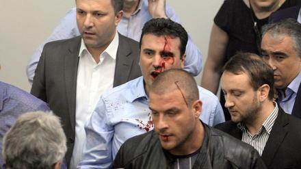 Zoran Zaev, Anführer der Sozialdemokraten, wurde massiv verprügelt.