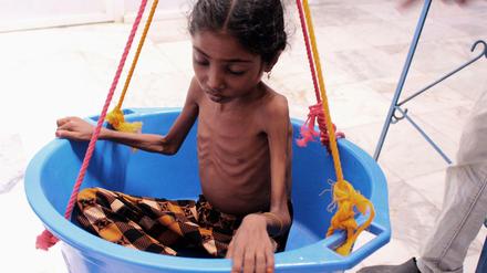 Vom Leben schwer gezeichnet. Save the Children zufolge sind fast zwei Millionen jemenitische Kinder mangelernährt.