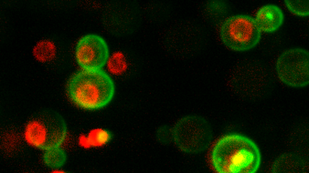 Hefezellen enthalten etwa 42 Millionen Proteinmoleküle.
