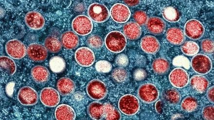 Eine mikroskopische Aufnahme von Partikeln des Affenpockenvirus in einer infizierten Zelle.