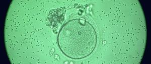Umstritten. Sobald Ei- und Samenzelle verschmelzen, gilt nach dem Urteil des Europäischen Gerichtshofes für den Embryo die Menschenwürde.