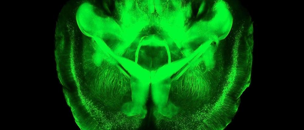 Das ganze Bild. Durch die grüne Färbung werden nicht nur die groben Strukturen des Gehirns sichtbar. Forscher können selbst die Verbindungen zwischen einzelnen Nervenzellen nachverfolgen.