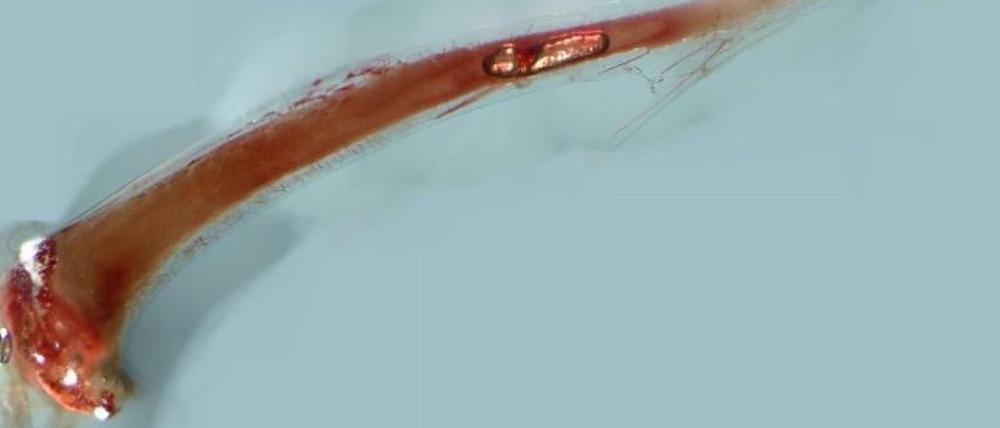 Am Rand dieses durch "Clearing" durchsichtig gemachten Mausknochens finden sich Hunderte feinster Kapillaren. Dabei handelt es sich um die neu entdeckten Transkortikalgefäße.