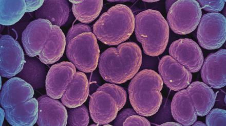 Neisseria-gonorrhoeae-Bakterien verursachen die Gonorrhö, die umgangssprachlich auch als Tripper bezeichnet wird.