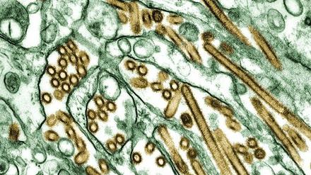 Das Vogelgrippe-Virus H5N1 (braun) kann sich in menschlichen Zellen nur schlecht vermehren. Die viralen Vermehrungsenzyme passen nicht zu einem menschlichen Protein.