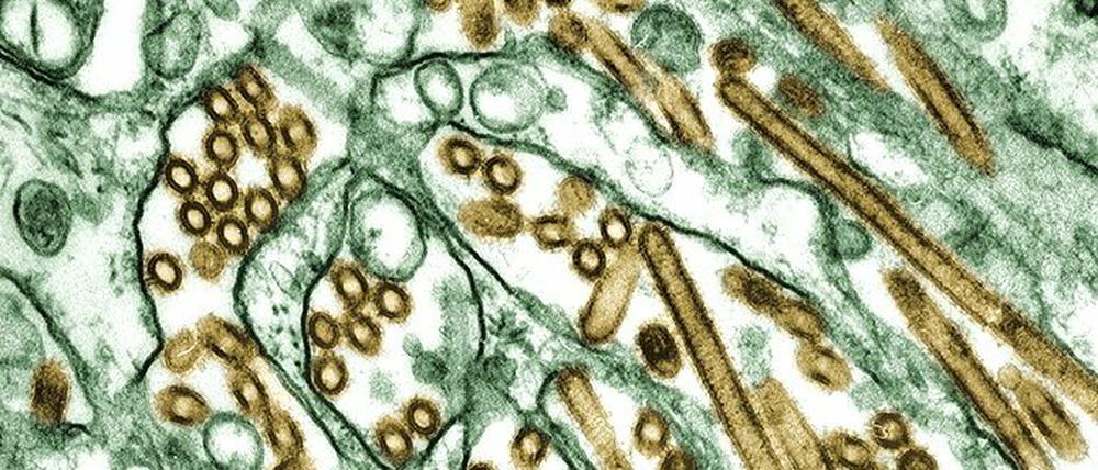 Das Vogelgrippe-Virus H5N1 (braun) kann sich in menschlichen Zellen nur schlecht vermehren. Die viralen Vermehrungsenzyme passen nicht zu einem menschlichen Protein.