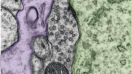 Elektronenmikroskopie. Hier sieht man zwischen einem Astrozyten (lila) und dem Zellkörper einer Nervenzelle (grün) eine von synaptischen Vesikeln gefüllte hemmende Synapse. Die Abwesenheit des Proteins AP180 führt dazu, dass die Signalweiterleitung dort gestört ist.