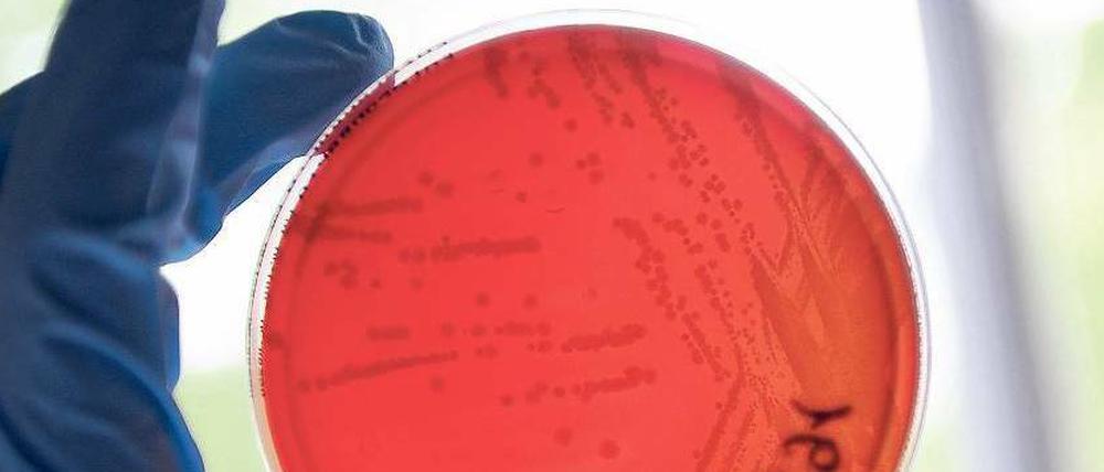 Im Visier der Mikrobenfahnder. Mikrobiologen und Seuchenexperten versuchen zu klären, woher der EHEC-Erreger stammt. Eine exakte „Typenbestimmung“ des Bakteriums im Labor ermöglicht die genaue Zuordnung zur Quelle des Keims - falls diese gefunden werden sollte. 