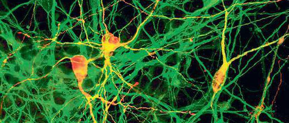 Alles auf Anfang. Gurdon und Yamanaka zeigten an Tieren, dass man erwachsene Zellen zurückprogrammieren kann. Mittlerweile geht das auch beim Menschen. Aus den so gewonnenen Stammzellen können Forscher zum Beispiel neue Nervenzellen züchten. Foto: Reuters