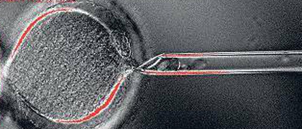 Entkernt. Im ersten Schritt entfernten die Forscher den Kern aus einer menschlichen Eizelle. In diese brachten sie dann den Kern einer Hautzelle. Daraus entwickelte sich schließlich ein Embryo. 