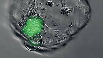 Diabetes geklont. Menschlicher Embryo mit Erbgut (grün) einer Patientin.