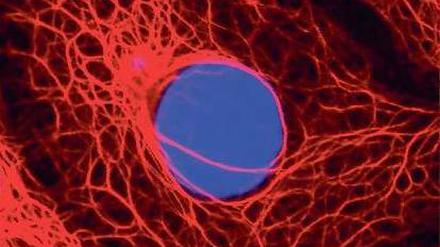 Ein paar falsche Genbausteine im Erbgut (blau) einer Zelle, können das Risiko, an Brustkrebs zu erkranken, erheblich steigern. Per Gentests lassen sich diese Mutationen nachweisen, doch damit ist längst nicht klar, was dann zu tun ist.
