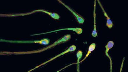 Samenzellen aus der Retorte könnten unfruchtbaren Männern helfen.