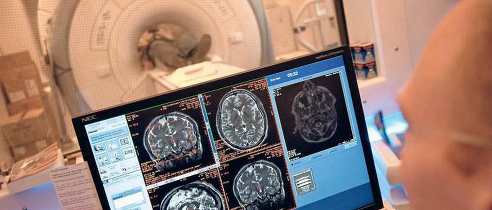 Detaillierter Einblick. Bei modernen Untersuchungen – hier eine Kernspintomografie zur Untersuchung des Gehirns – werden viele Aufnahmen erzeugt. Computerprogramme können helfen, auffällige Veränderungen schneller aufzuspüren. 
