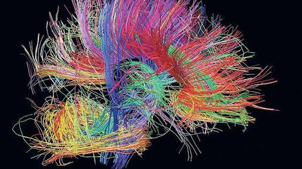Buntes Durcheinander. Wenn bei Parkinson-Patienten die Dopamin-produzierenden Zellen im Gehirn sterben, dann kommen die Impulse zwischen den vernetzten Nervenzellen im Gehirn durcheinander und die Bewegungen geraten ins Stocken. 