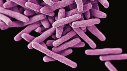 Global Player. 3D-Bild eines Clusters von Mycobacterium tuberculosis. Der Erreger begleitet uns seit Tausenden von Jahren. Auch er mutiert. In jüngster Zeit tut er dies vor allem in einer Weise, die es zunehmend erschwert, seiner mit Antibiotika Herr zu werden. 