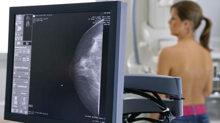 Wenn bei der Mammografie ein "duktales Karzinom" in der Brust entdeckt wird, verbessert eine radikale Amputation die Überlebenswahrscheinlichkeit nicht, so eine Studie an über 100.000 Frauen. 