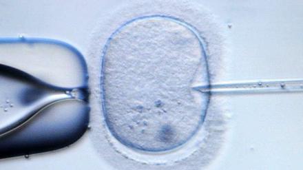 Experiment mit Folgen. Für die neue Gentherapie wird einer befruchteten Eizelle der Vorkern entnommen und in die Eizell-Hülle einer Spenderin eingesetzt. So soll das Kind alle relevanten Gene von Mutter und Vater bekommen und trotzdem gesund bleiben.
