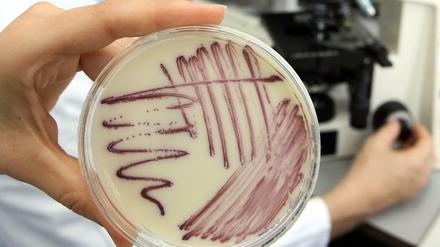 Gefährliche Erreger. Eine Petrischale mit MRSA-Keimen (Methicillin-resistenten Staphylococcus aureus). 