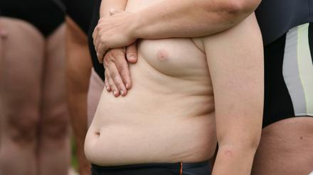 Die Zahl der übergewichtigen Kinder hat weltweit zugenommen, sagt eine Kommission der Weltgesundheitsorganisation. 41 Millionen Kinder seien übergewichtig.