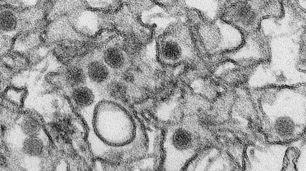 Zika-Viren, hier in einer elektronenmikroskopischen Aufnahme, sind etwa 40 Nanometer große, kugelförmige Viren der Flaviviridae-Familie. Sie stehen im Verdacht, der Hirnentwicklung von Kindern im Mutterleib infizierter Schwangerer zu schaden und bei Erwachsenen neurologische Komplikationen zu verursachen.