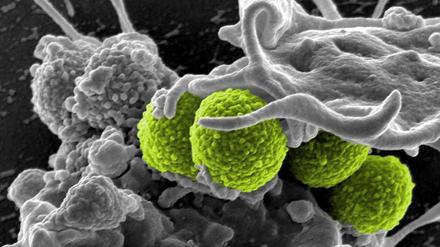 Das am National Institute of Allergy and Infectious Diseases in den USA erstellte Bild zeigt grün gefärbte MRSA-Bakterien, umhüllt von weißen Blutkörperchen.