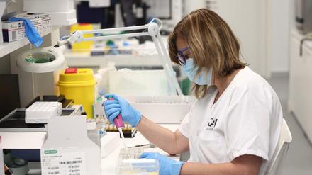 Eine Labortechnikerin arbeitet mit PCR-Tests zur Erkennung des Affenpockenvirus. 