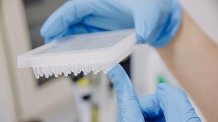 PCR-Test zur Erkennung des Affenpockenvirus: 18 Fälle der Viruserkrankung sind für Berlin inzwischen bestätigt.