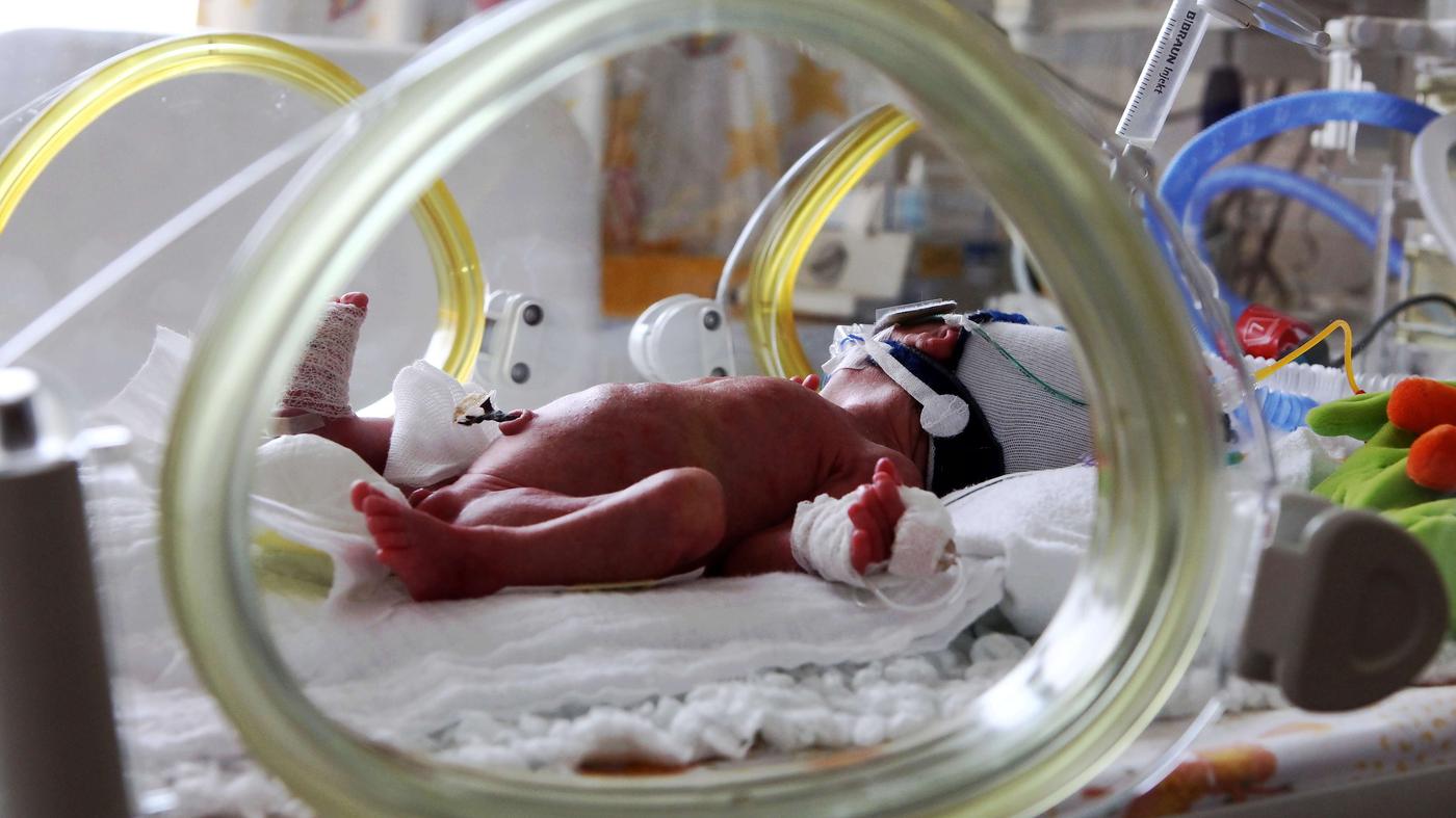 Ребенок родился в 6 месяцев. Недоношенные Новорожденные. Семимесячный жеребенок.