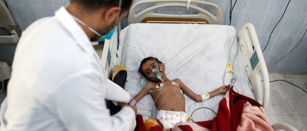 Schon jetzt leiden mehr als acht Millionen Menschen im Jemen unter schwerer Unterversorgung.