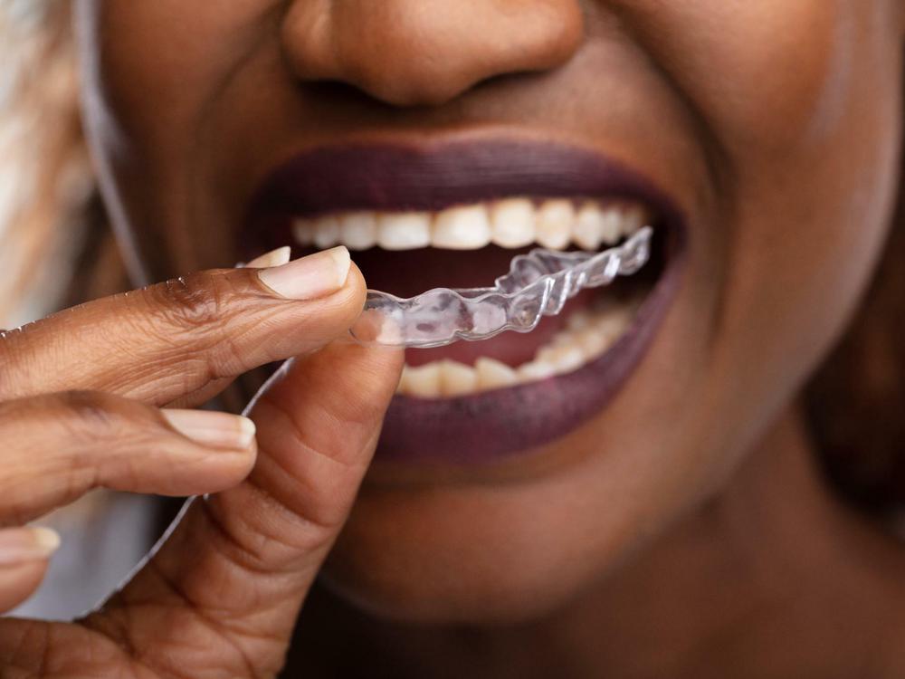 Zähneknirschen – Ursachen, Behandlung, Folgen: Was bei Bruxismus hilft