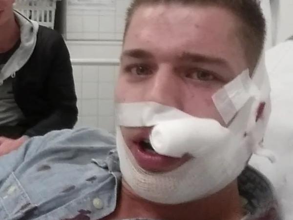 Leon M. erlitt Verletzungen an Ohr und Gesicht. Er wurde mit einem Bierglas geschlagen.